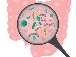 La prolifération bacterienne de l'intestin grêle propre au SIBO