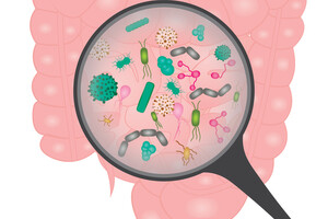La prolifération bacterienne de l'intestin grêle propre au SIBO