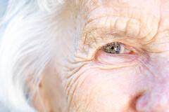 Les patients opérés de la cataracte ont 30 % de risque en moins de développer une démence.