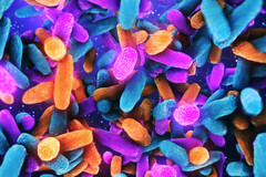 Microbiote : des anomalies responsables de démence