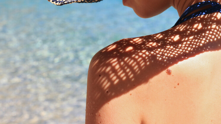 L’épiderme et le derme, ont un rôle majeur dans la protection de la peau contre le soleil.