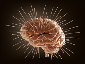 Quels effets mesurables sur le cerveau pour l'acupuncture ?