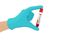Un test simplifié pour le coronavirus, rapidement disponible ?