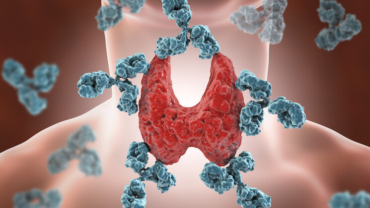Lors d'une maladie d'Hashimoto, les anticorps s'attaquent à la thyroïde