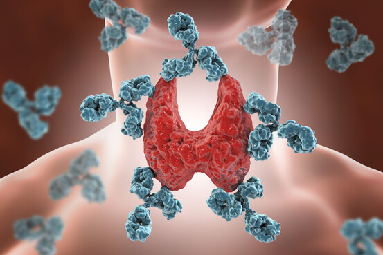 Lors d'une maladie d'Hashimoto, les anticorps s'attaquent à la thyroïde