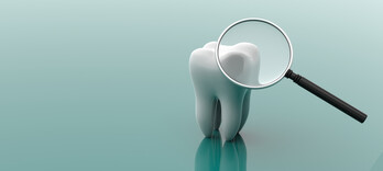 Les dents, baromètre de notre santé - Alternative Santé
