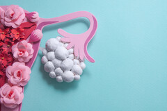 SOPK : moins de glucides pour améliorer votre fertilité
