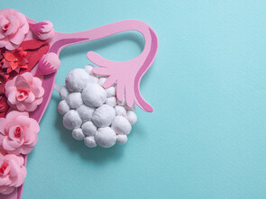 SOPK : moins de glucides pour améliorer votre fertilité