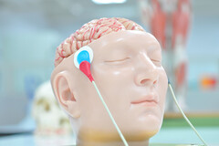 La neurostimulation peut améliorer la qualité de vie des migraineux chroniques.
