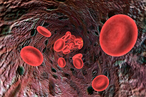Causes et facteurs de risque de l’hypertension artérielle