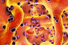 Bactéries ayant colonisé le tissu osseux