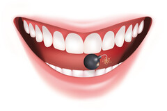 On ne suspecte pas la dangerosité de la plaque dentaire