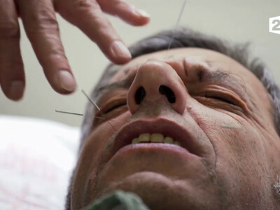 Michel Cymes teste l'acupuncture... sans en dire du mal