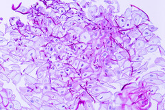 La candidose est une sorte de mycose qui colonise les cavités (intestin, bouche, vagin)