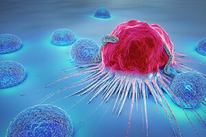 Une cellule cancéreuse attaquée par des lymphocytes.
