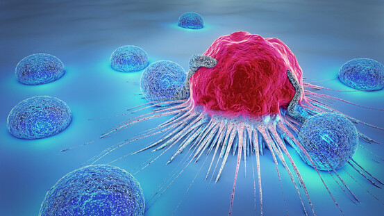 Une cellule cancéreuse attaquée par des lymphocytes.