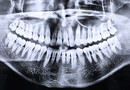 Les liens entre sphère bucco-dentaire et autres pathologies sont extrêmement nombreux.