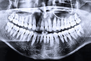 Les liens entre sphère bucco-dentaire et autres pathologies sont extrêmement nombreux.