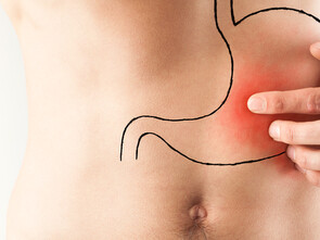 L'ulcère de l'estomac et l'acidité sont souvent associés à Helicobacter pylori