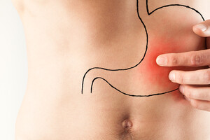 L'ulcère de l'estomac et l'acidité sont souvent associés à Helicobacter pylori