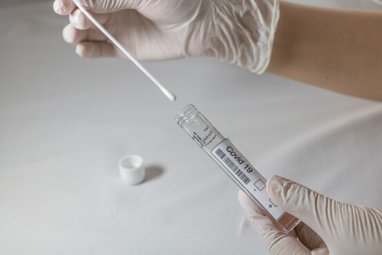 « Cas de Covid-19 » en augmentation : les tests PCR en trompe-l'oeil