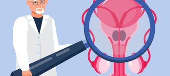 Prostate : l’influence du métabolisme et du microbiote - Alternative Santé