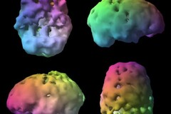 Vision 3D du cerveau grace au SPECT