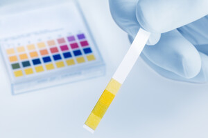 Il est possible d'acheter du papier pH en pharmacie pour tester son pH urinaire.