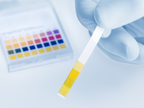 Il est possible d'acheter du papier pH en pharmacie pour tester son pH urinaire.