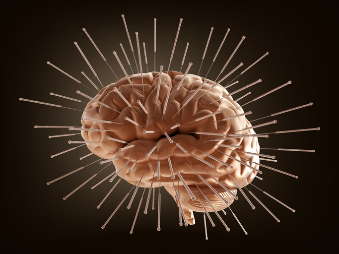 L’acupuncture : des effets mesurables sur le cerveau